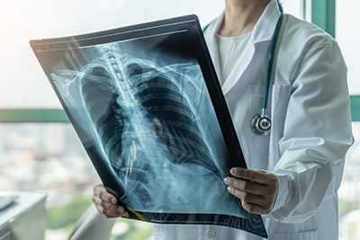 Vacunas y refuerzos contra la COVID-19